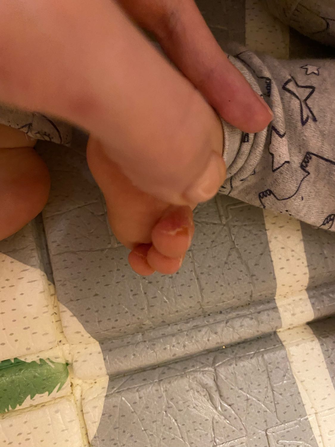 Сегодня обнаружила, что у ребенка кожа облазит на пальчиках ног. На чт... image №3