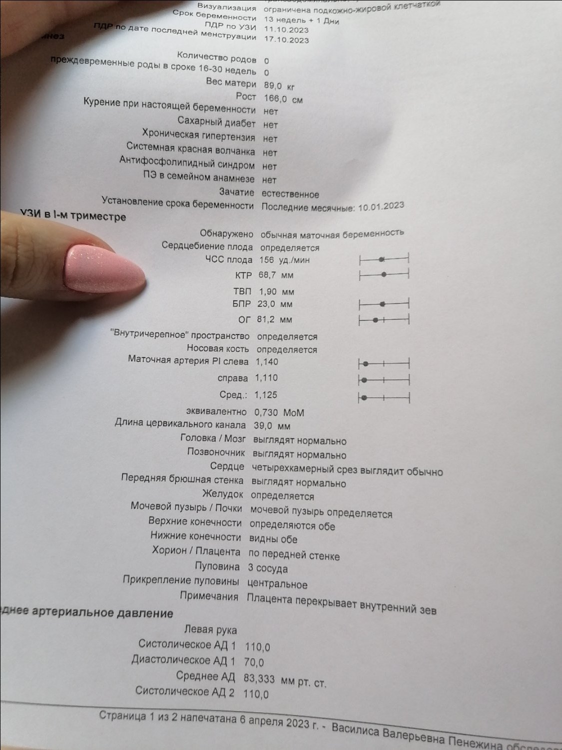 Хочу с вами поделиться - была сегодня на первом скрининге. Фотографиро... image №2