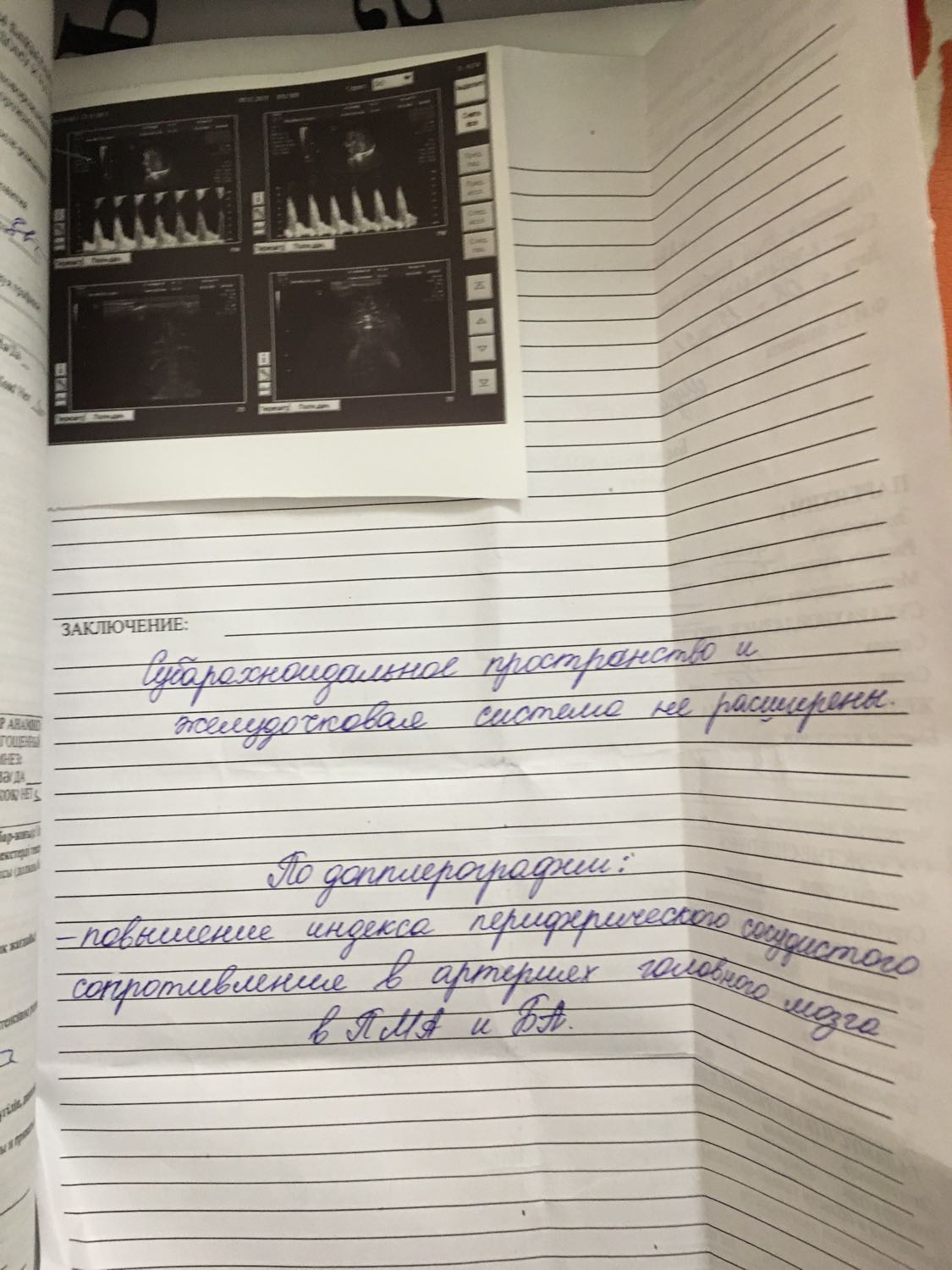 Здравствуйте мамочки💐 ребенку 1 месяц,сегодня слелали узи головного мо... 