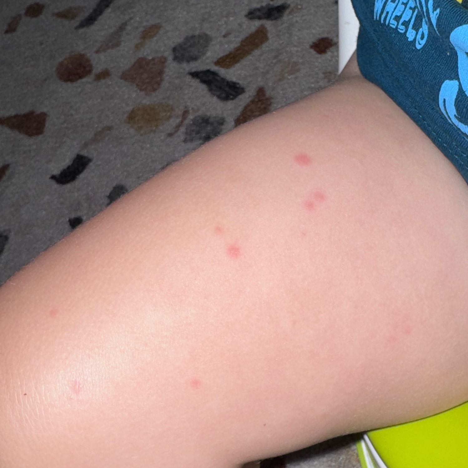 Please tell me, does this look like a food allergy?
