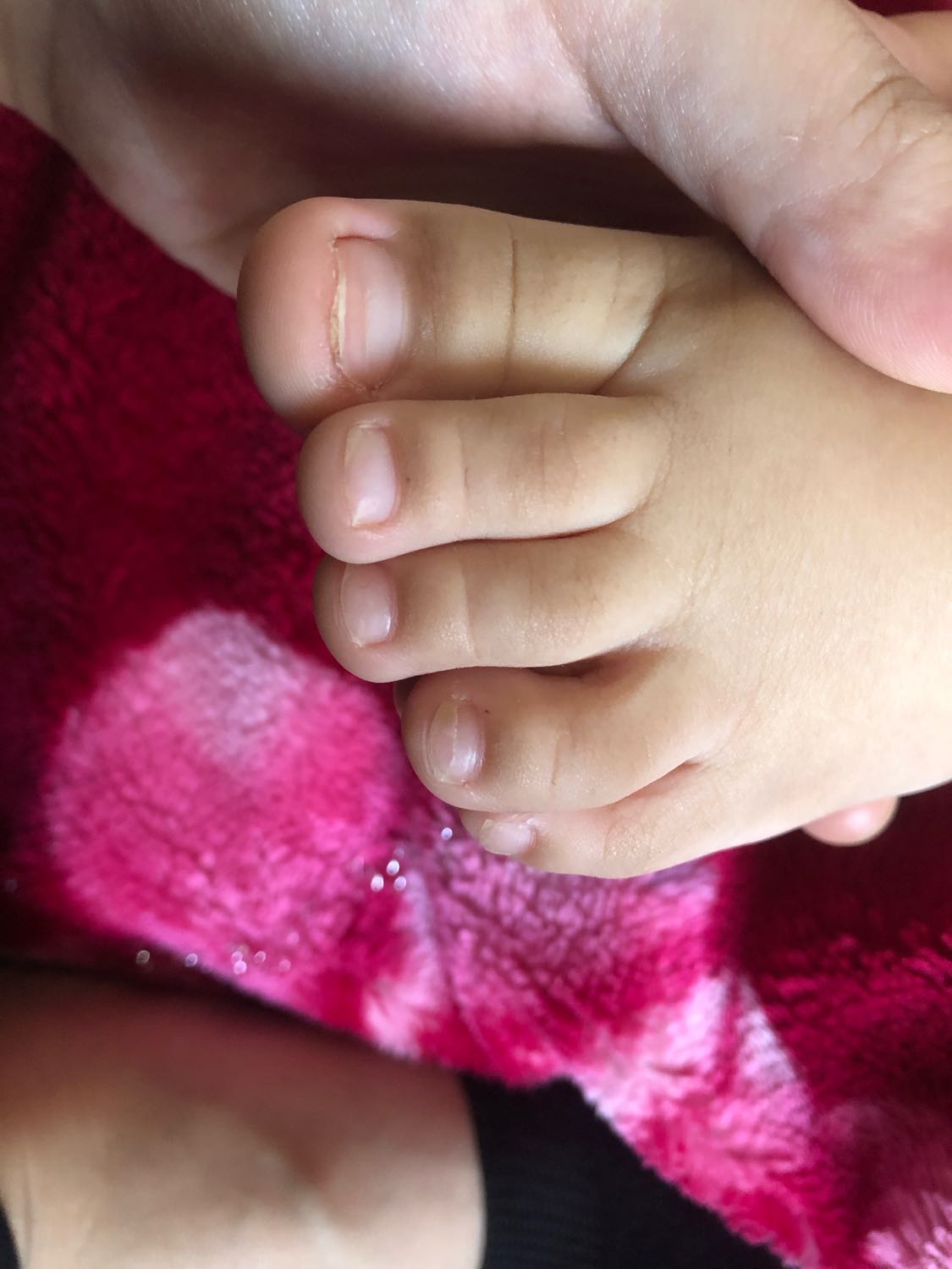 Девочки, ребенку ровно 2 года и его состояние ногтей ужасное 😣 в ноябр... 