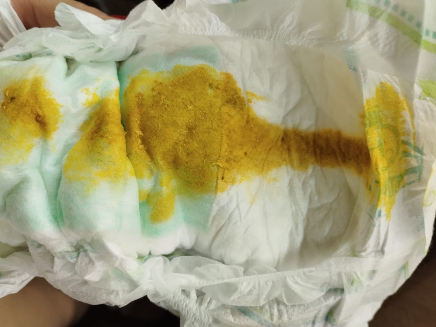 Здравствуйте у моей ребёнке  2 месяцев каждый день плачет . Гв .
 Не з... 