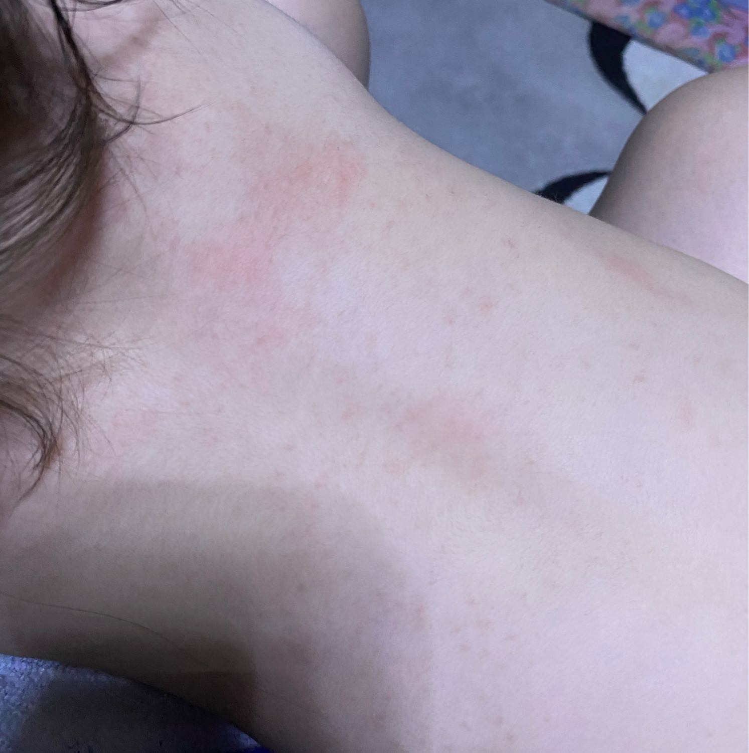Всем привет девочки. Подскажите пожалуйста 
Осыпало дочу😰 маленькие кр... image №2