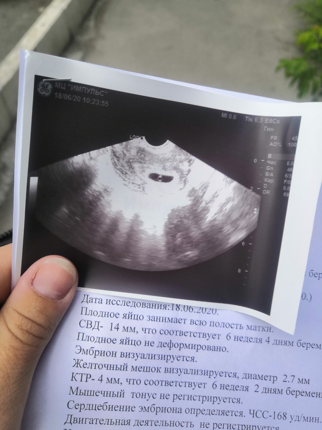 Посты пользователей из приложения image №6