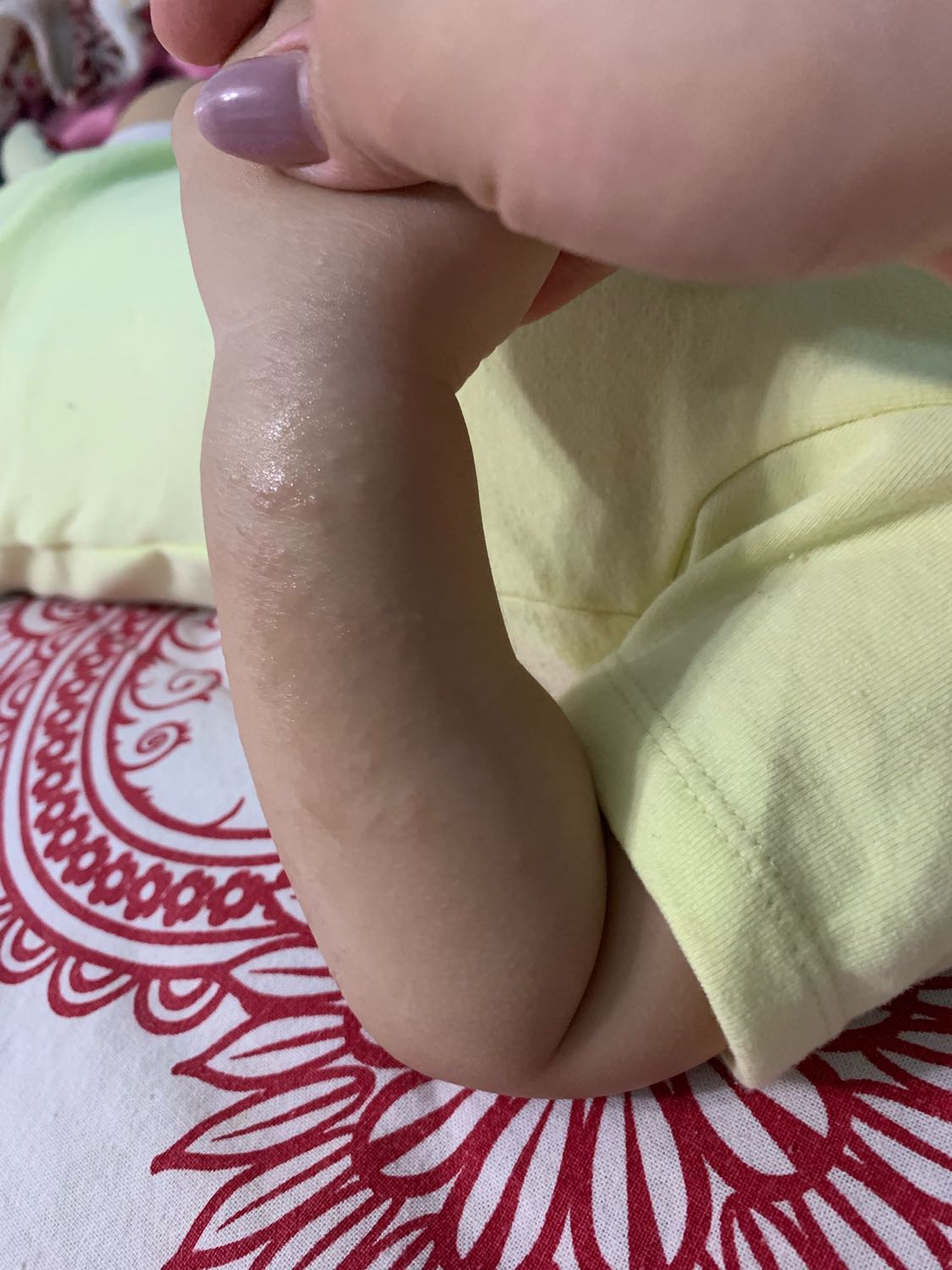 Приветики всем!! Дочке год 3м , и у нее сыпь , откуда не знаю🤦🏻‍♀️врод... image №2
