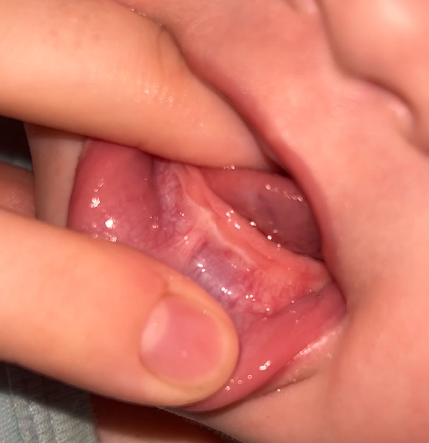 Hello!!! Please tell me, is she teething or should I put the "panic" o…