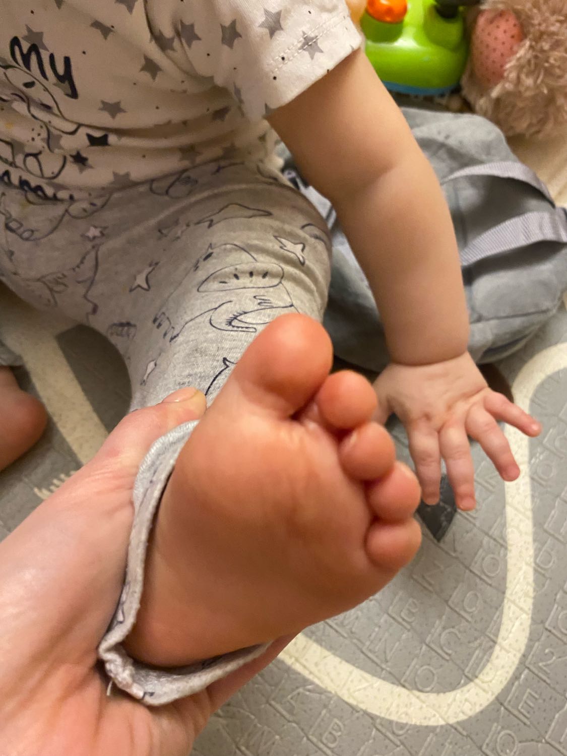 Сегодня обнаружила, что у ребенка кожа облазит на пальчиках ног. На чт... image №2