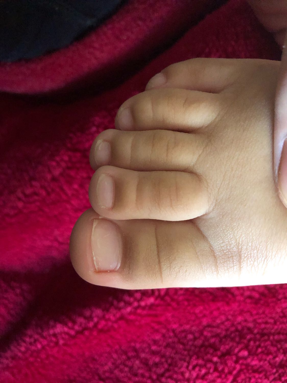 Девочки, ребенку ровно 2 года и его состояние ногтей ужасное 😣 в ноябр... image №2