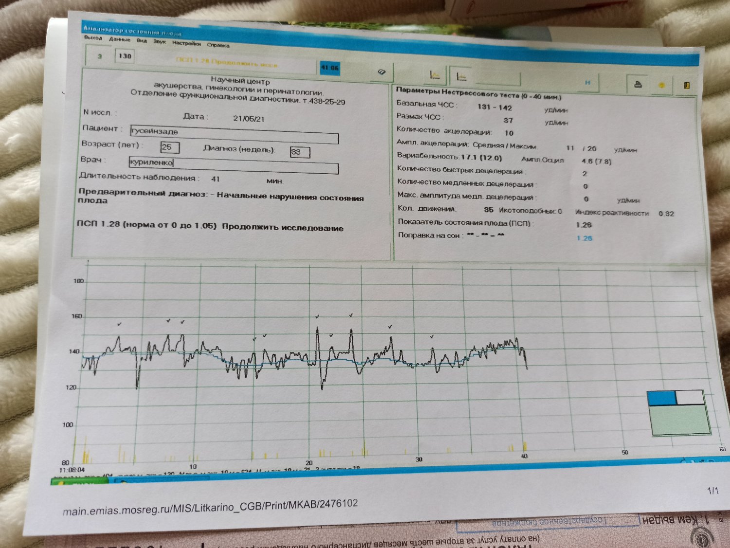 Девочки, была сегодня на КТГ,врач сказал немного не хорошие показатели... 