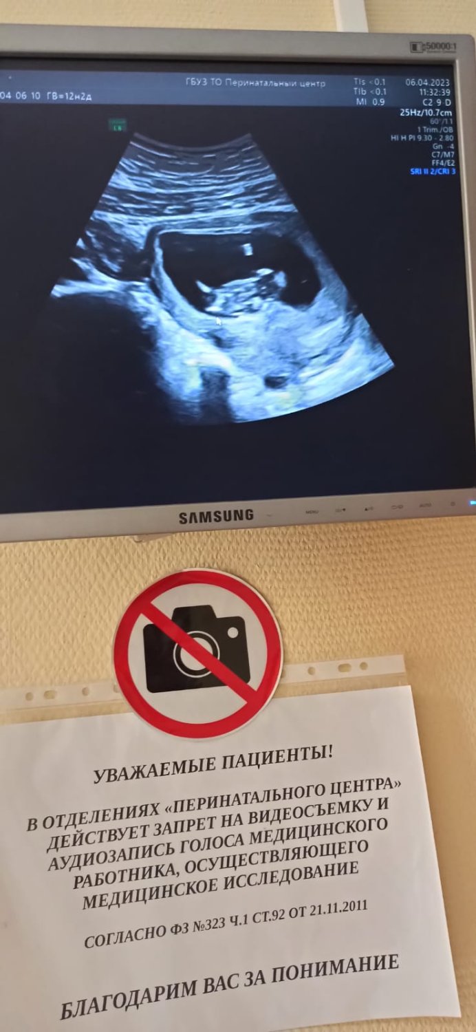 Хочу с вами поделиться - была сегодня на первом скрининге. Фотографиро... 