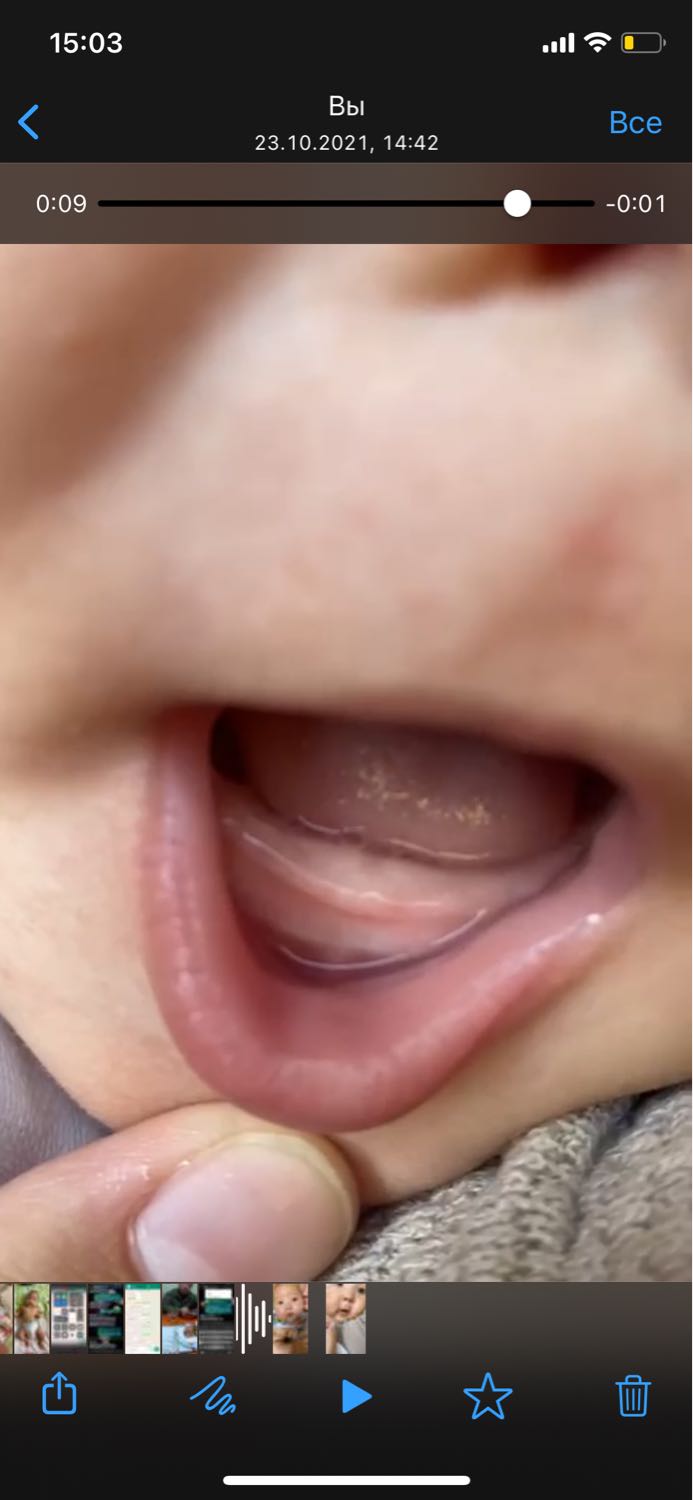 Как понять что у ребенка режутся зубы? image №3