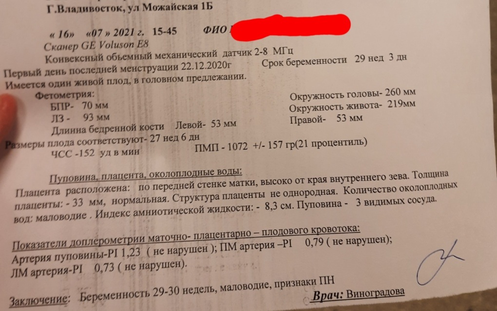 Здравствуйте,у меня сегодня 35 недель ровно по месячным,была на узи,ре... image №2