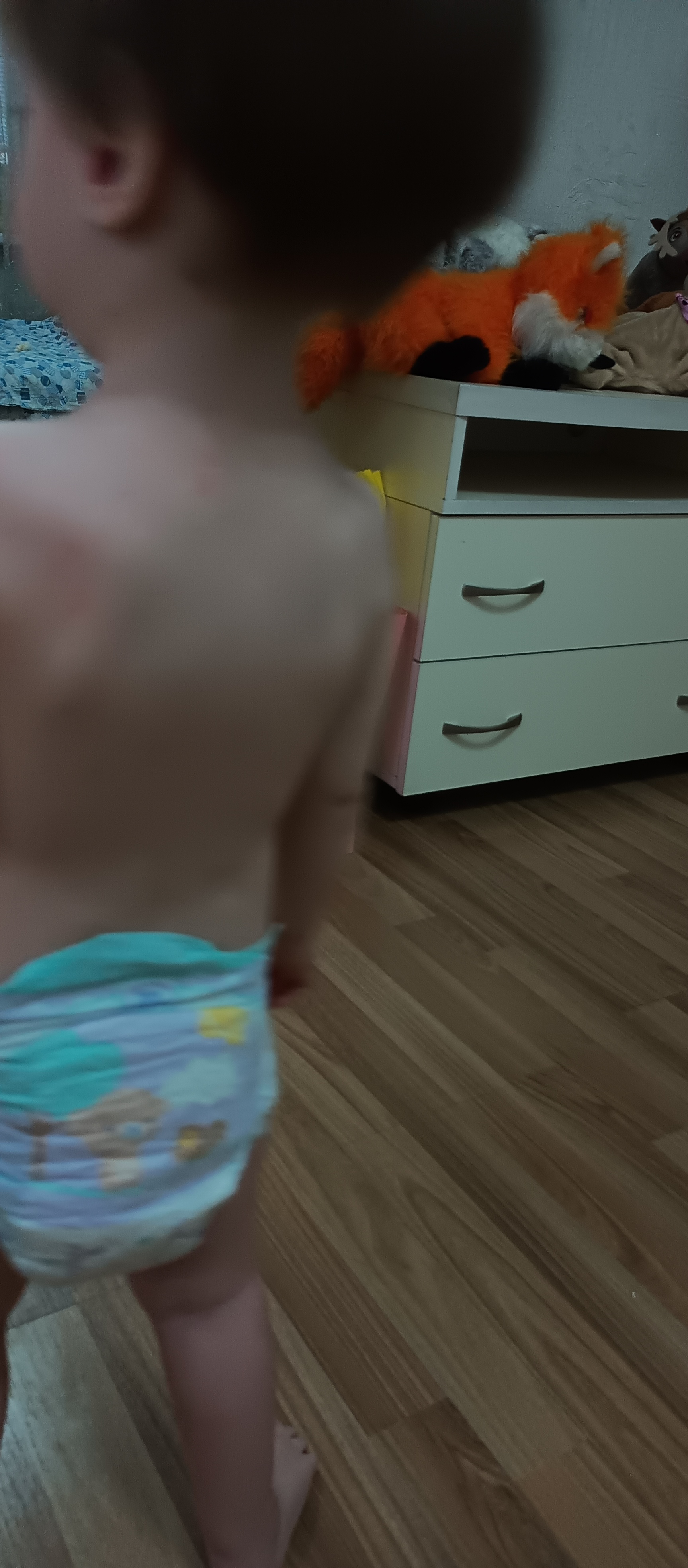 Девочки SOS !? 
Мы уже дома как 3 день, сейчас заметила у него сыпь 
Н... image №2