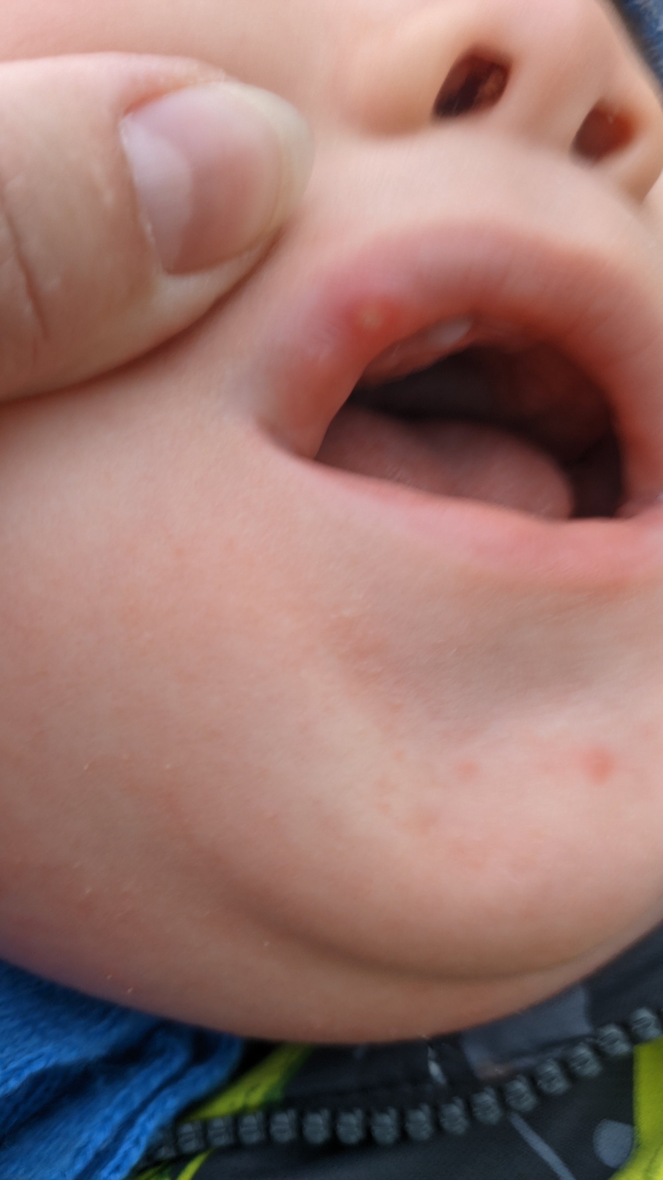Девочки подскажите, можно прижечь зелёнкой на губе болячку внутри ребе... image №2