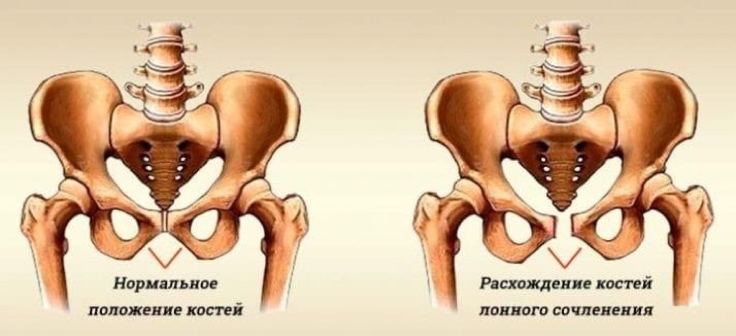 Фото Лобковой Кости