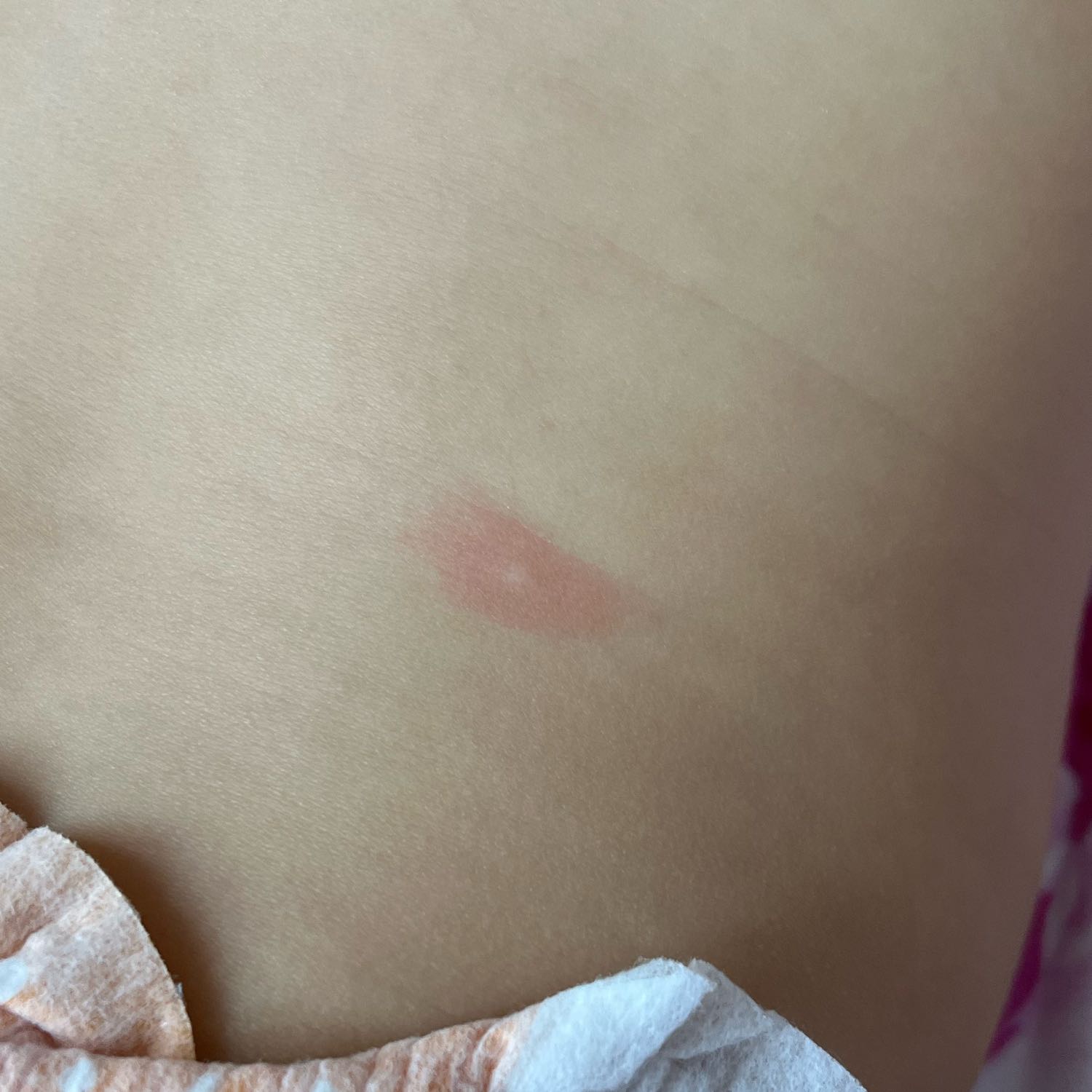 Всем привет! Что это может быть? Каждый день в разных местах появляетс... image №2