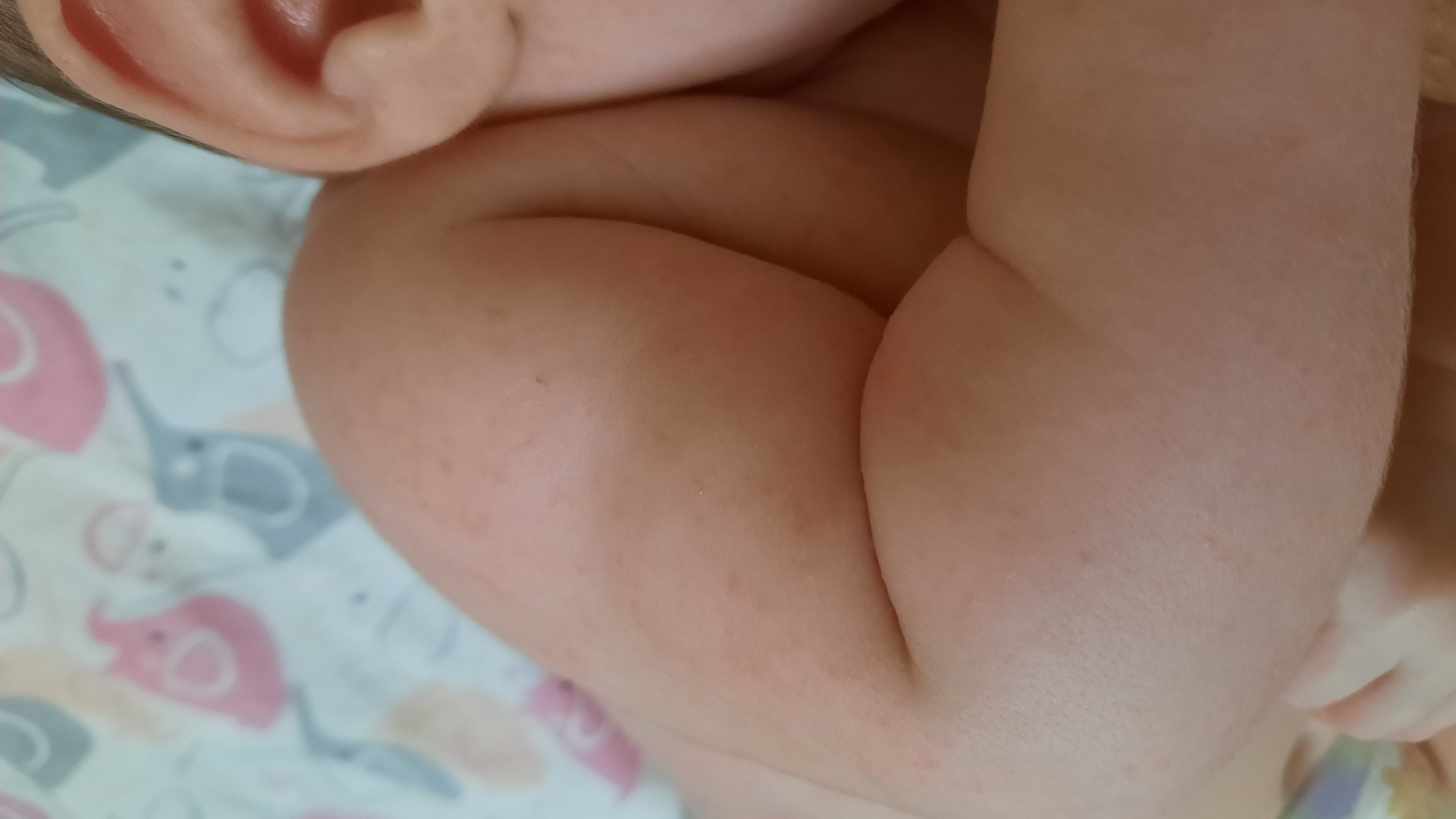 Девчёнки помогите,что это потничка или алергия???😫😱 image №5
