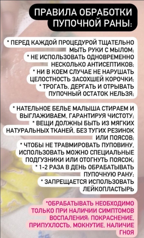 Про пупок новорождённого image №2