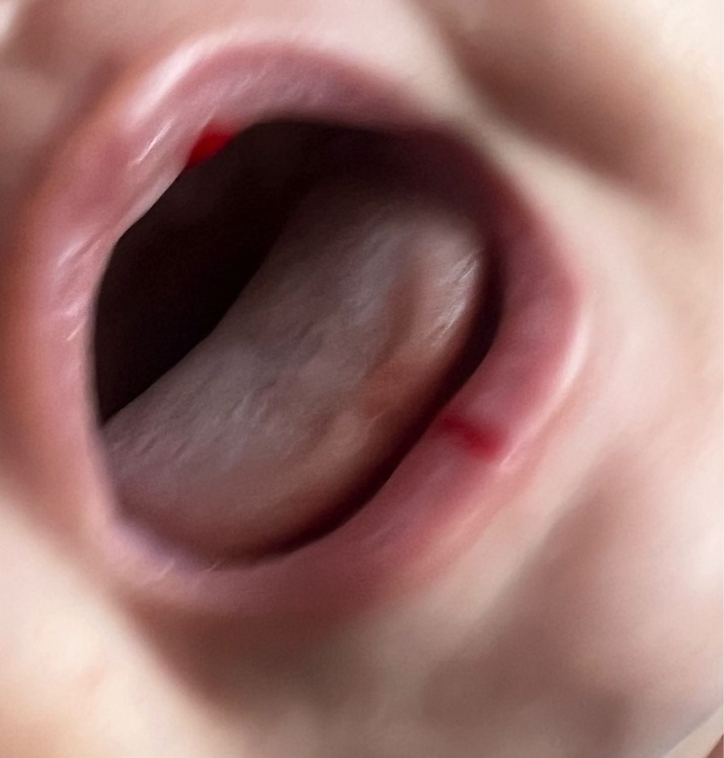 добрый день! у малыша кровоточат губы когда плачет(прикрепила фото)что... image №2