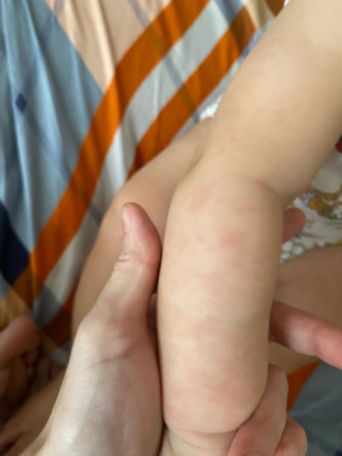 Что это может быть ? Точно не потница, потому что уже прохладно дома. ... image №2