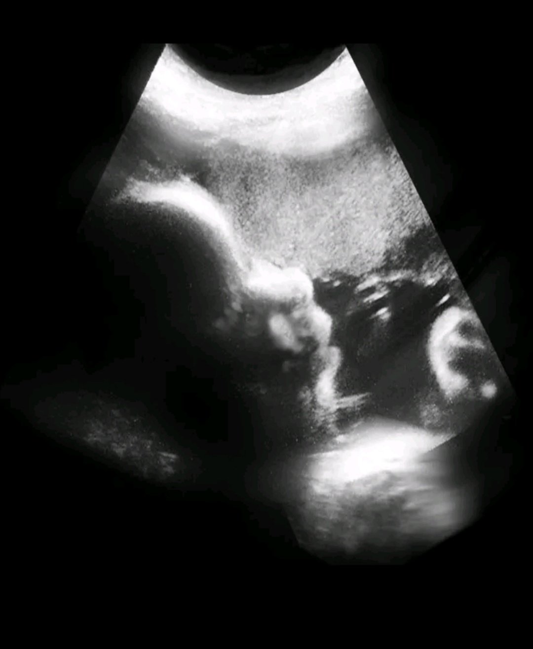 Моя маленькая девочка 🤰❤️ 