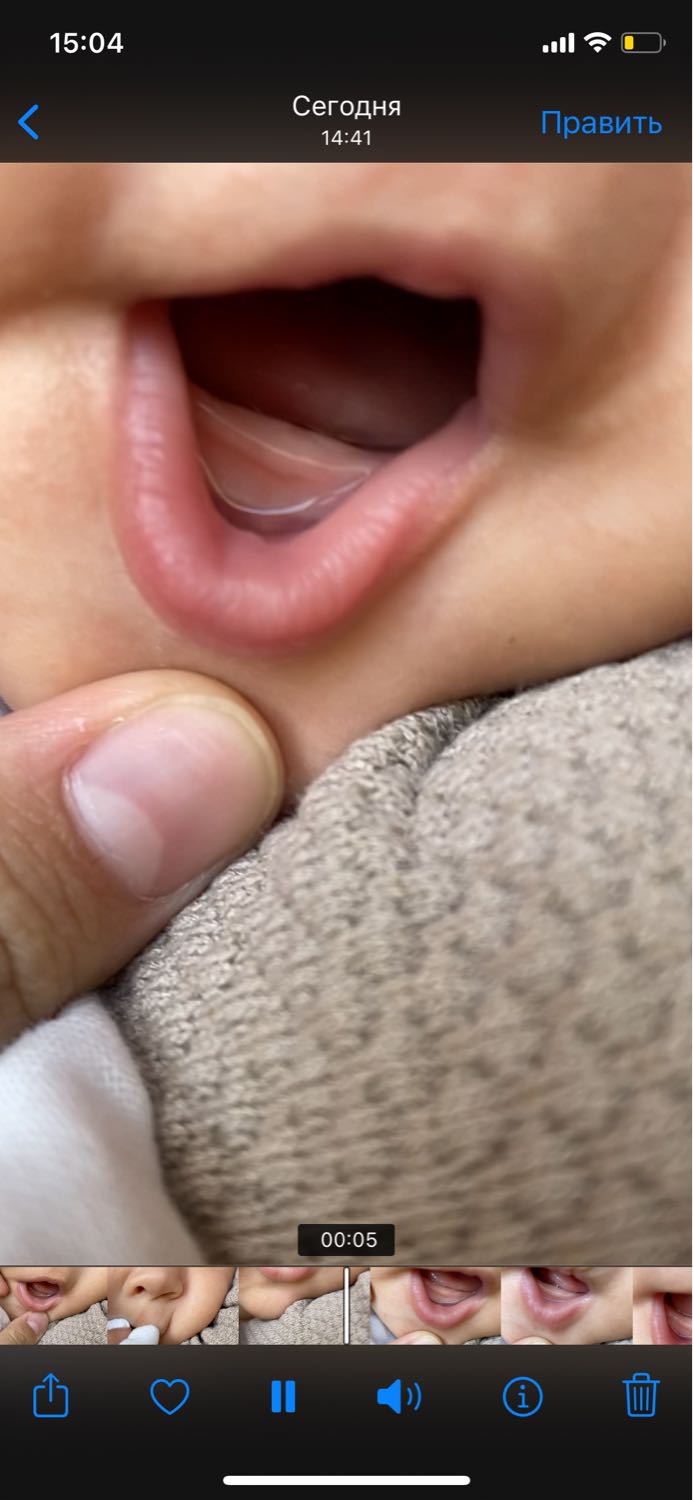 Как понять что у ребенка режутся зубы? image №2