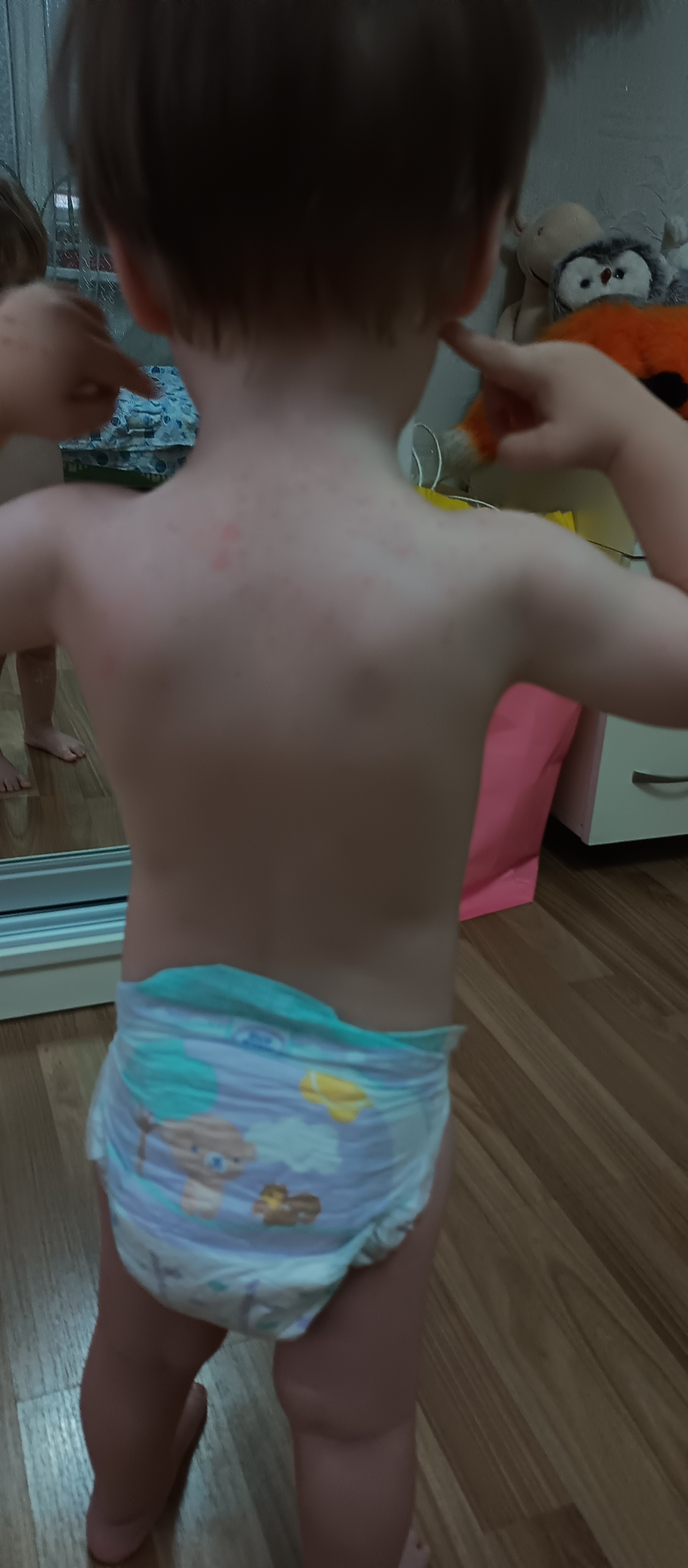 Девочки SOS !? 
Мы уже дома как 3 день, сейчас заметила у него сыпь 
Н... image №6