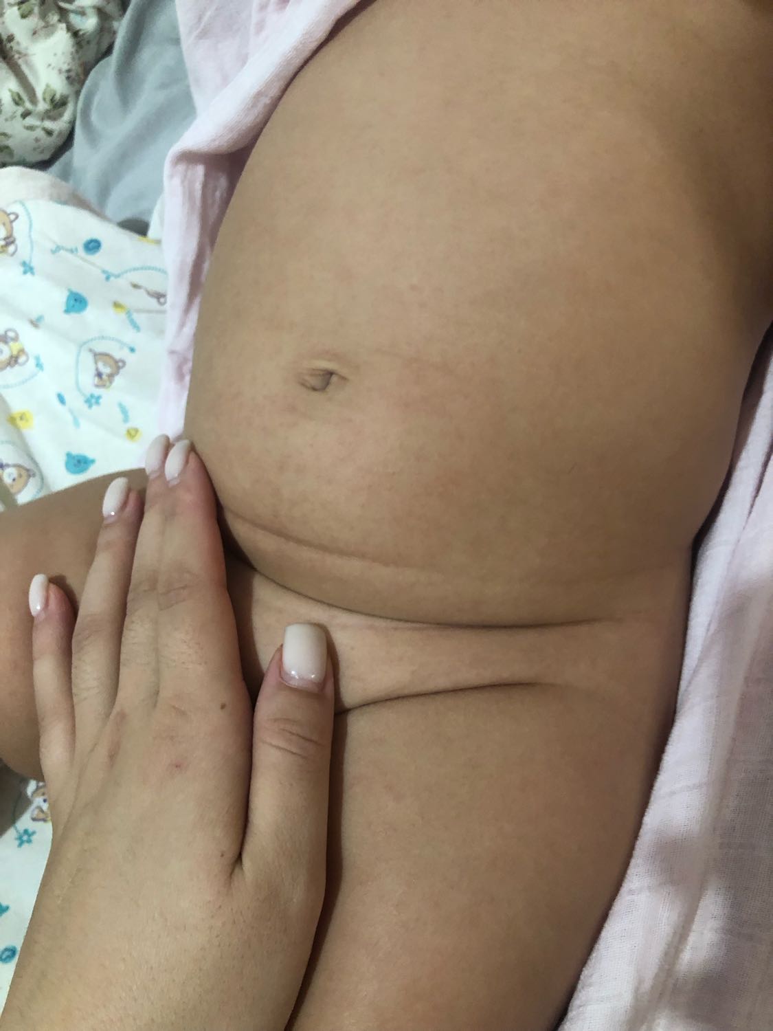 Мамочкииии SOOOS , 
С утра заметила , подскажите пожалуйста, что это т... image №2